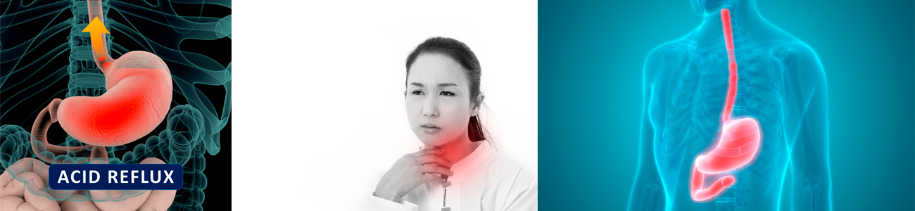 Nasal and Sinus Irragation